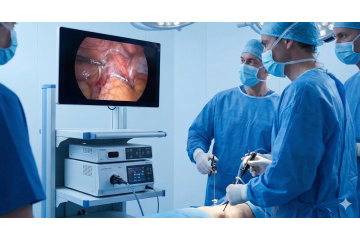 Як обрати ендоскопічну відеосистему для сучасної хірургії: Гід по характеристикам та окупності