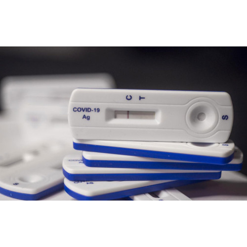 Швидкий тест на антиген коронавірусу 2019-nCoV